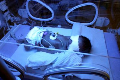 Infezione ospedaliera uccide 18 neonati in Giamaica, i medici: "Niente panico"